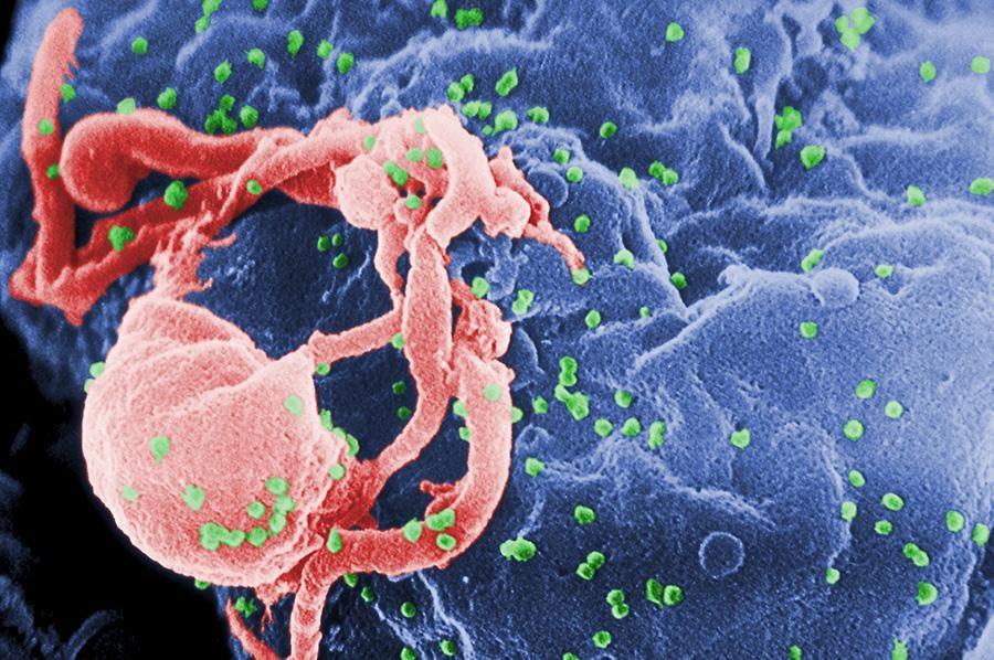 Progress in AIDS cure,  expert says