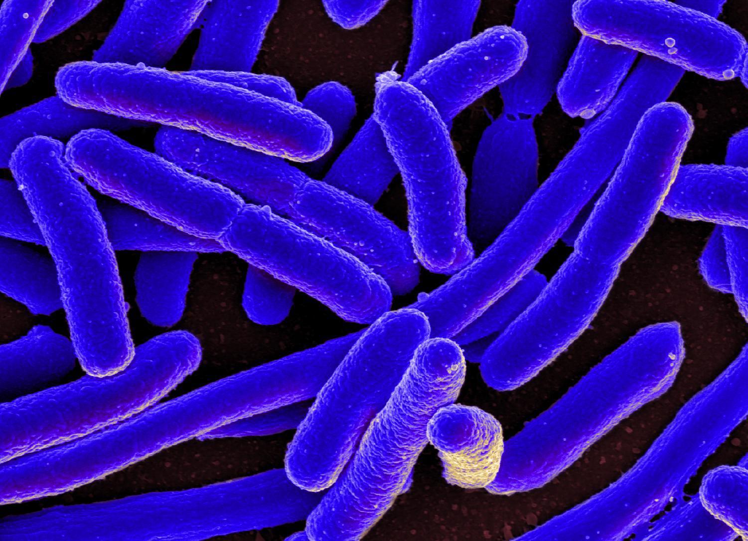 e-coli_wikimedia