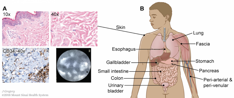 A body diagram depicting the layers of skin cells.