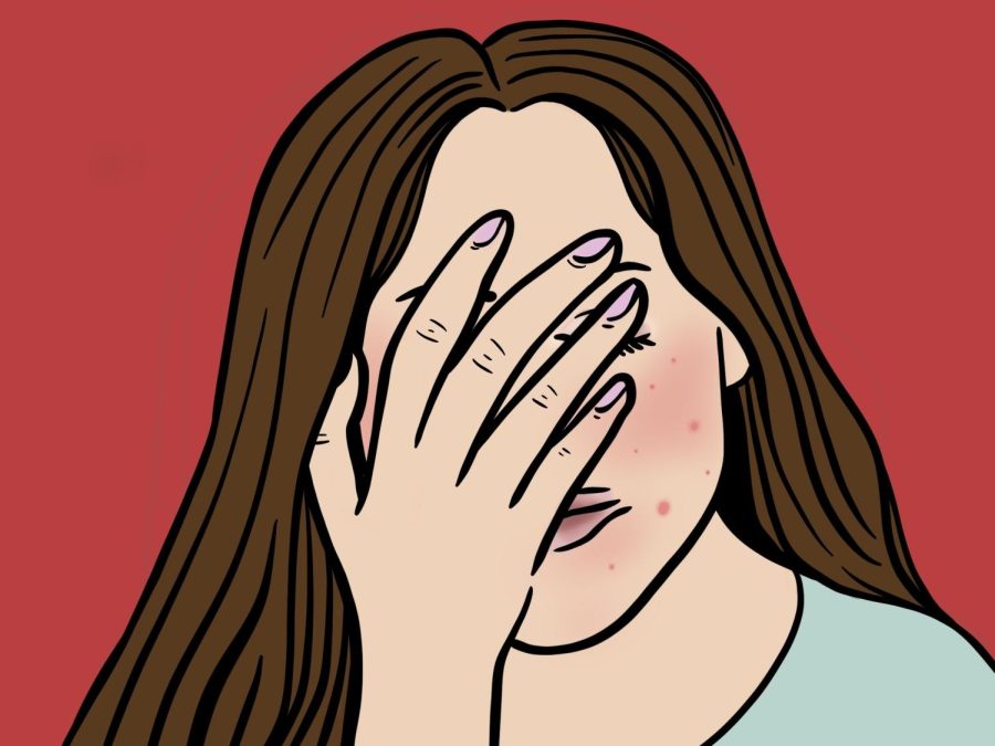 An illustration of a woman shielding her face with her hand to hide her acne. She has long brown hair and is wearing a teal t-shirt.