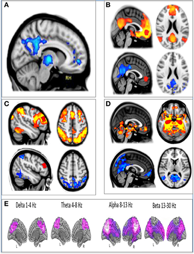 A figure showing the effects of psilocybin on F.M.R.I. and M.E.G. measures of brain activity.